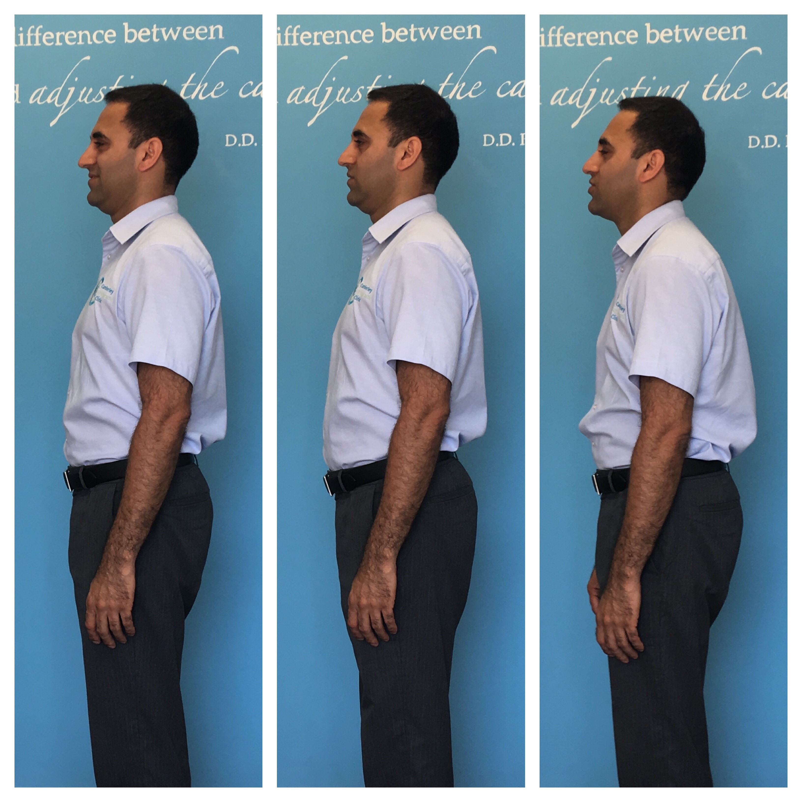 Importance of Good Posture : Types of Posture