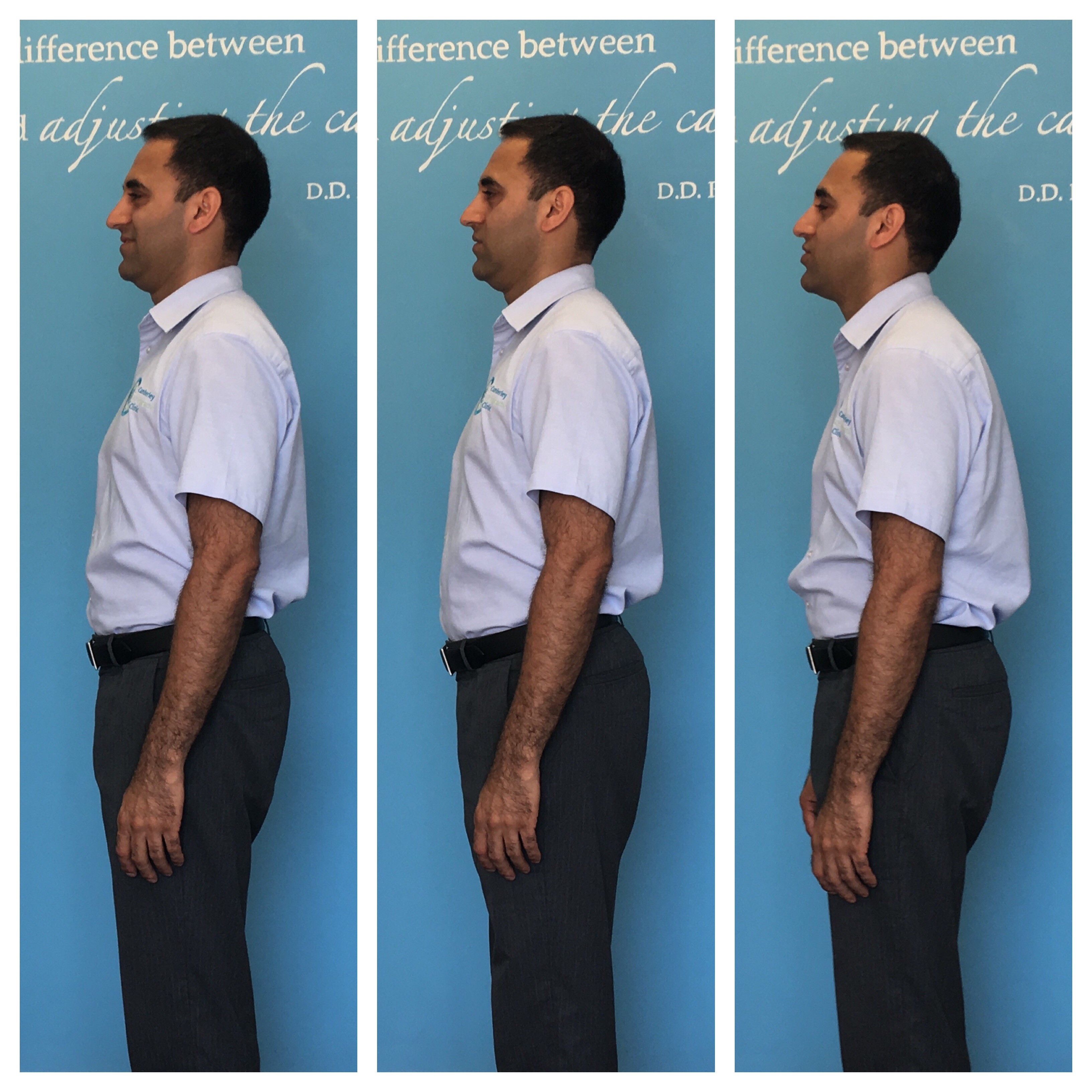 Why Posture Is Important — Sydney Spine & Sports Clinic